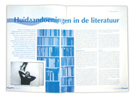 HUID